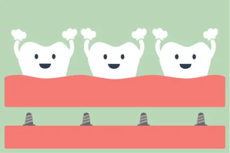 Why It’s Important to Replace Missing Teeth